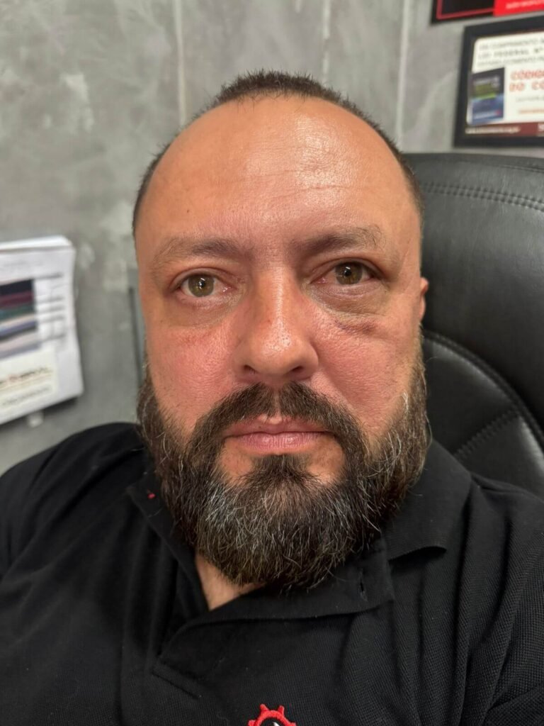 Resultado do pós-operatório de blefaroplastia após a recuperação, sem hematomas ou inchaço