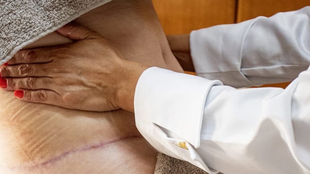 Andressa Costa avaliando cicatriz de abdominoplastia antes da aplicação do taping pós-operatório em Itu