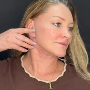 Evolução do pós-operatório de reestruturação facial