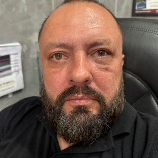 Resultado do pós-operatório de blefaroplastia após a recuperação, sem hematomas ou inchaço